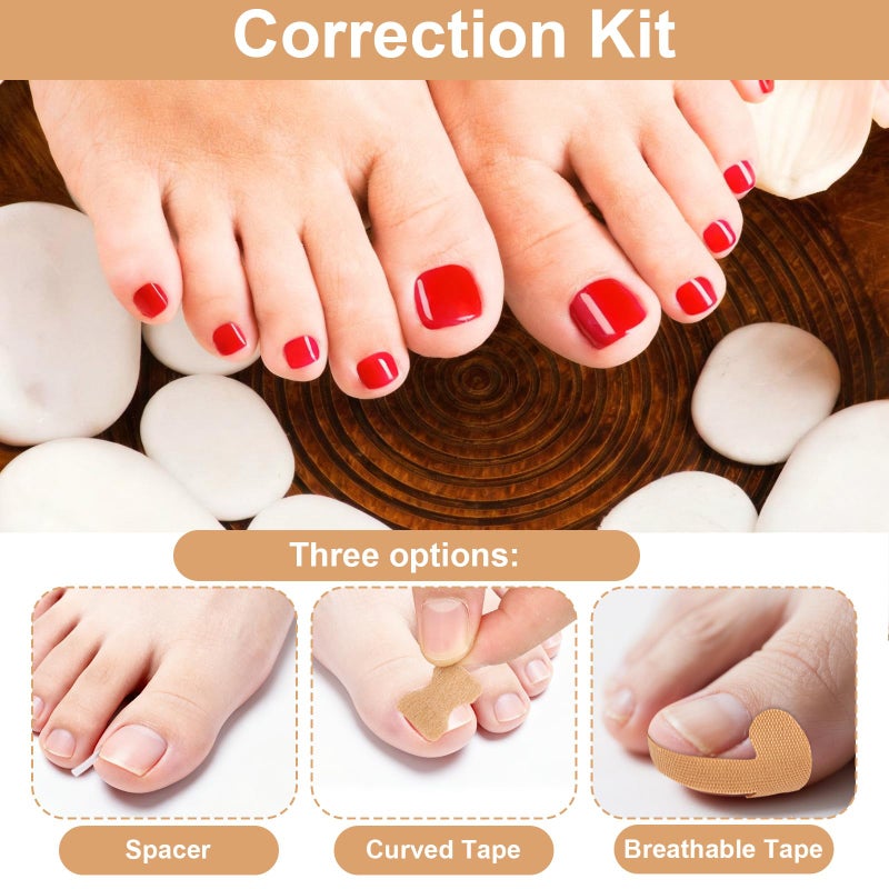 Sinbana 55pcs Ingrown Toenail Set, Include Breathable In-Growing Toenail Strips Curved Toes Patches Lifting Pedicure Tools & Pads Suitable for Home Pedicure - Image 3
